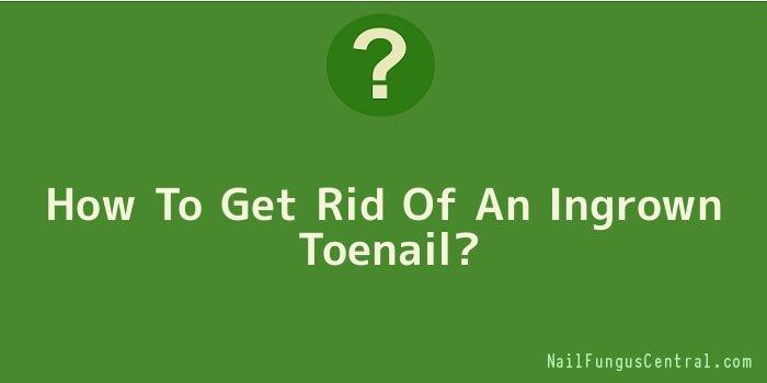 How To Get Rid Of An Ingrown Toenail