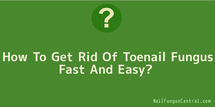 How To Get Rid Of Toenail Fungus Fast And Easy
