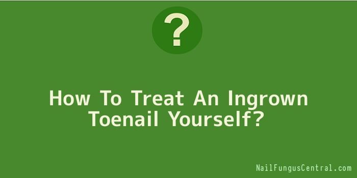 How To Treat An Ingrown Toenail Yourself