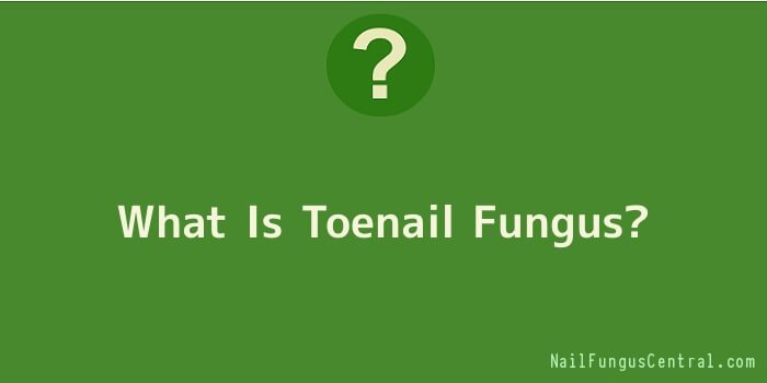 What Is Toenail Fungus