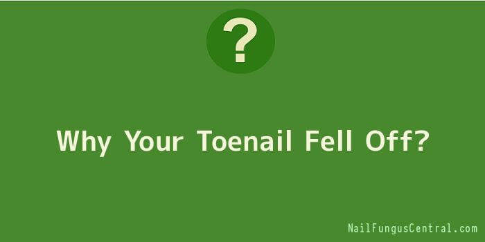 Why Your Toenail Fell Off