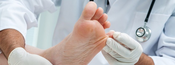 Nail Fungus Infection Treatment And Prevention