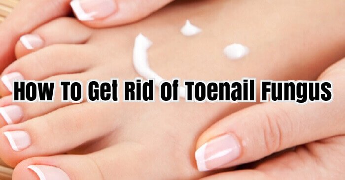 How To Get Rid of Toenail Fungus