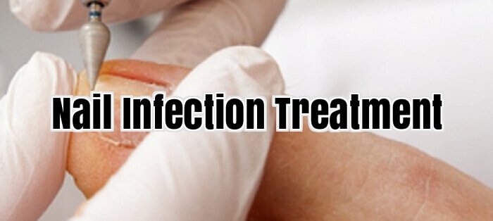 Nail Infection Treatment