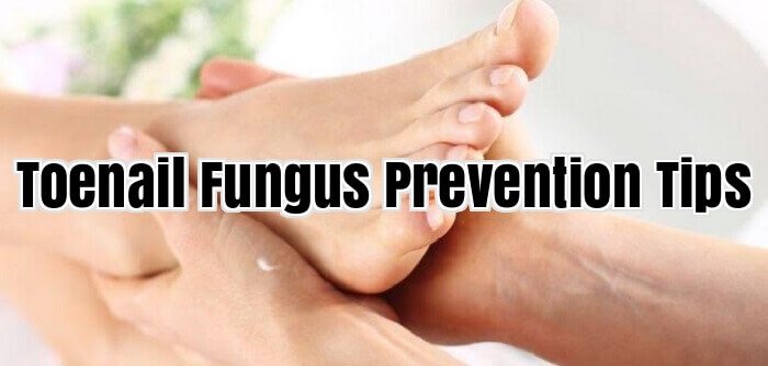 Toenail Fungus Prevention Tips