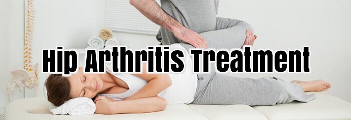 Hip Arthritis Treatment