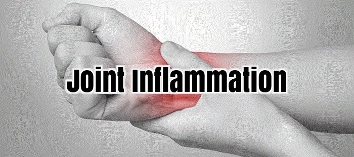 Joint Inflammation