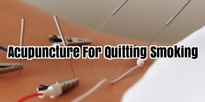 Acupuncture For Quitting Smoking