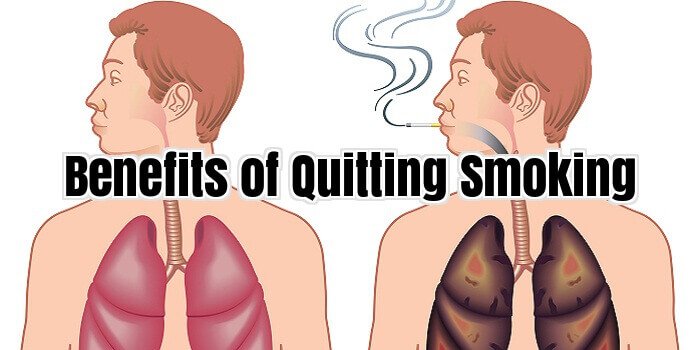 Benefits of Quitting Smoking