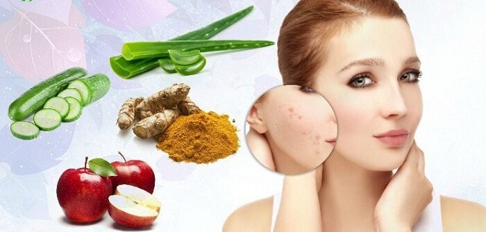 How To Treat Rosacea: A Look at Natural Treatments