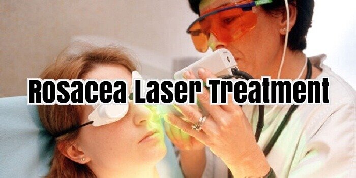 Rosacea Laser Treatment