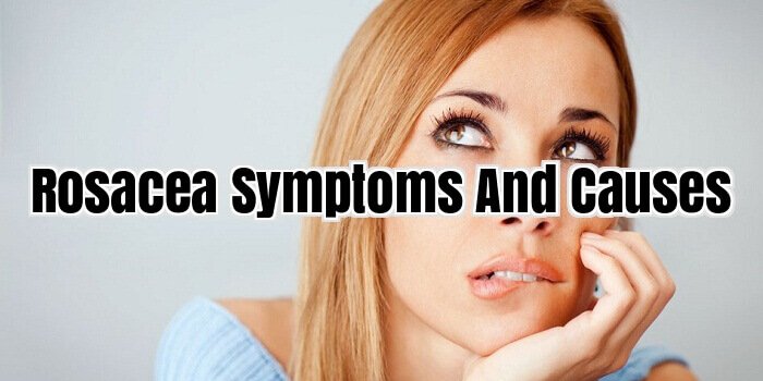Rosacea Symptoms and Causes