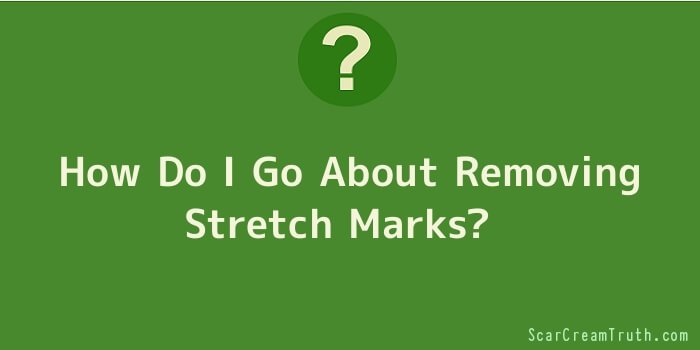 How Do I Go About Removing Stretch Marks