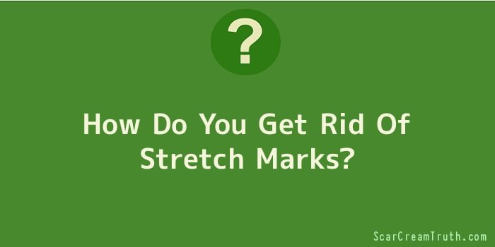 How Do You Get Rid Of Stretch Marks