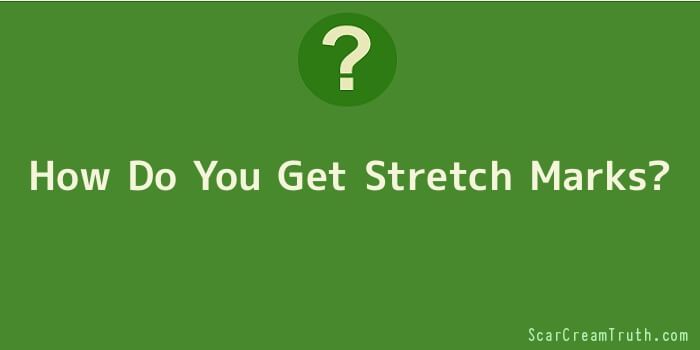 How Do You Get Stretch Marks