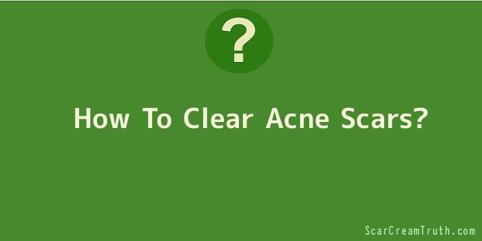 How To Clear Acne Scars