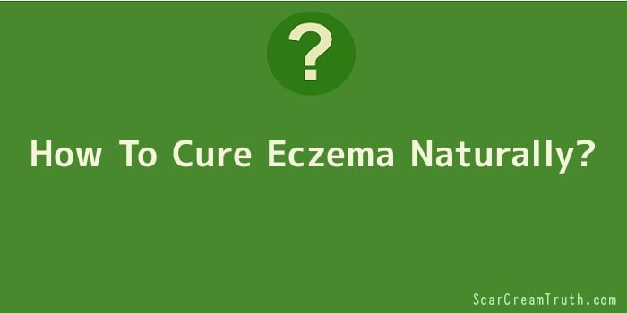 How To Cure Eczema Naturally