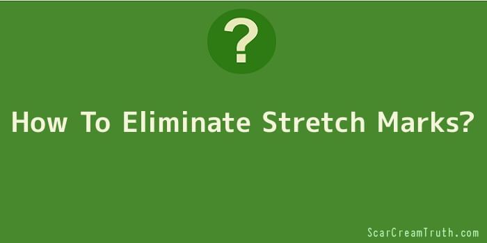 How To Eliminate Stretch Marks