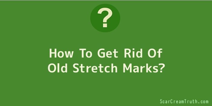 How To Get Rid Of Old Stretch Marks