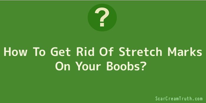How To Get Rid Of Stretch Marks On Your Boobs