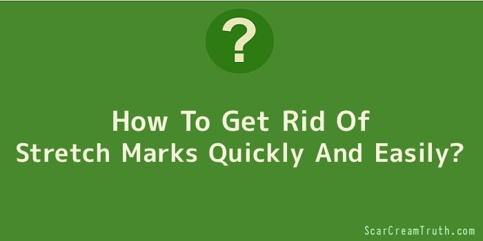 How To Get Rid Of Stretch Marks Quickly And Easily