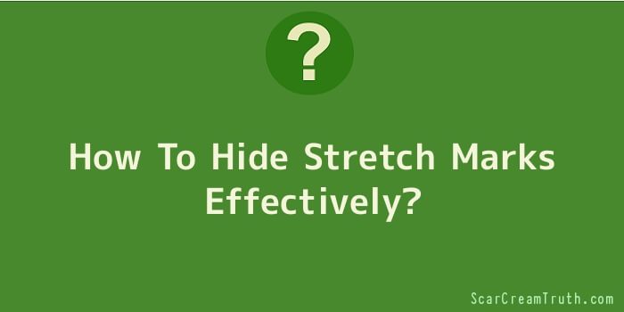 How To Hide Stretch Marks Effectively