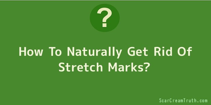 How To Naturally Get Rid Of Stretch Marks