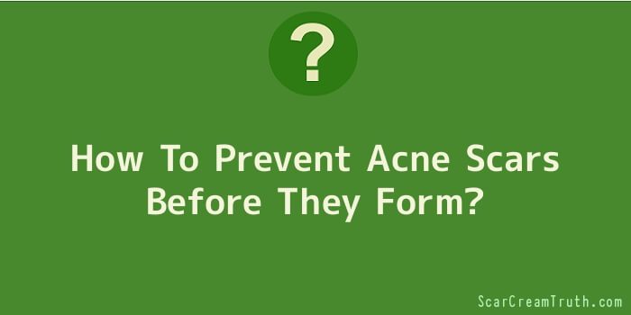 How To Prevent Acne Scars Before They Form