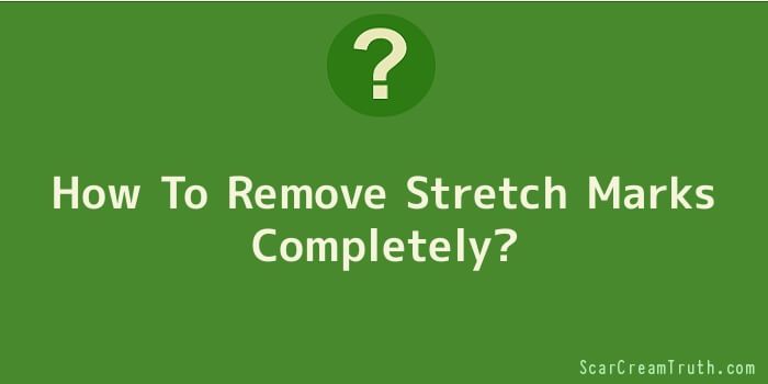 How To Remove Stretch Marks Completely