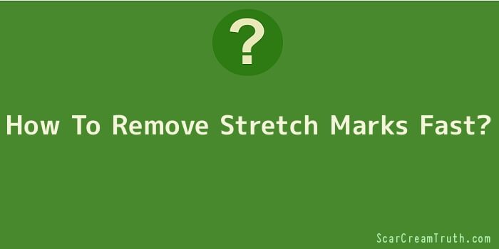 How To Remove Stretch Marks Fast