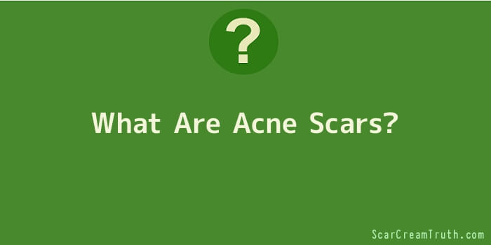 What Are Acne Scars