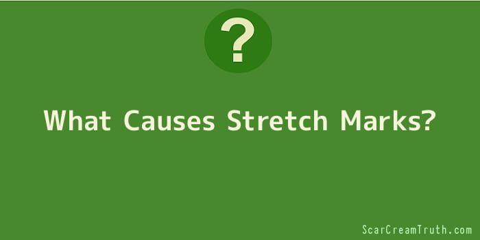 What Causes Stretch Marks