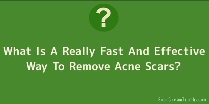 What Is A Really Fast And Effective Way To Remove Acne Scars