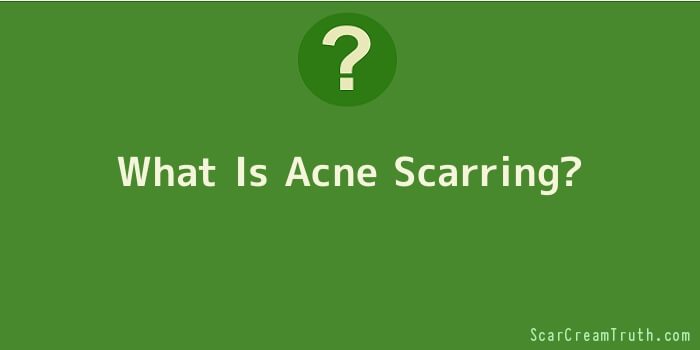What Is Acne Scarring