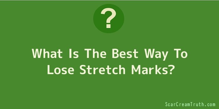 What Is The Best Way To Lose Stretch Marks