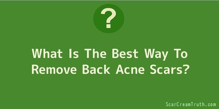 What Is The Best Way To Remove Back Acne Scars