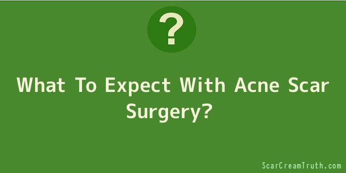 What To Expect With Acne Scar Surgery