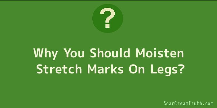 Why You Should Moisten Stretch Marks On Legs