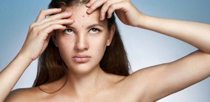 Useful Information On Finding The Best Scar Cream For Clearing Acne Scars