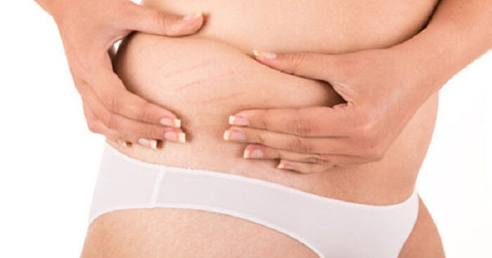 Home Remedies For Scars