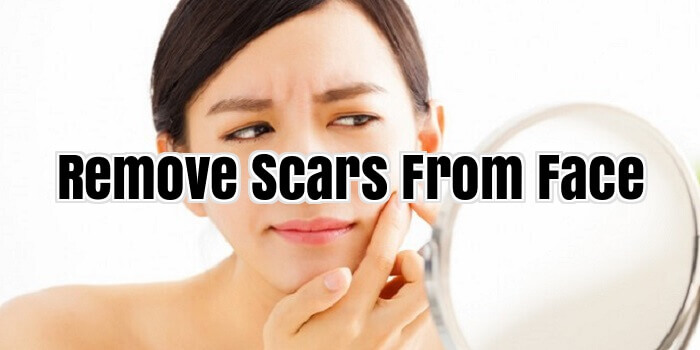 Remove Scars From Face
