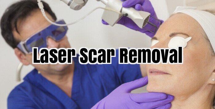 Laser Scar Removal