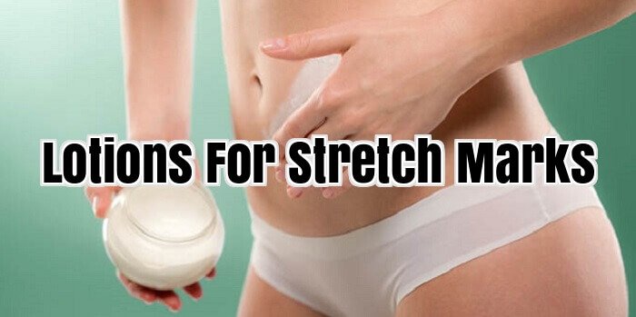 Lotions For Stretch Marks