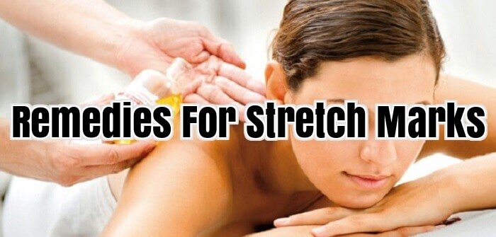 Remedies For Stretch Marks