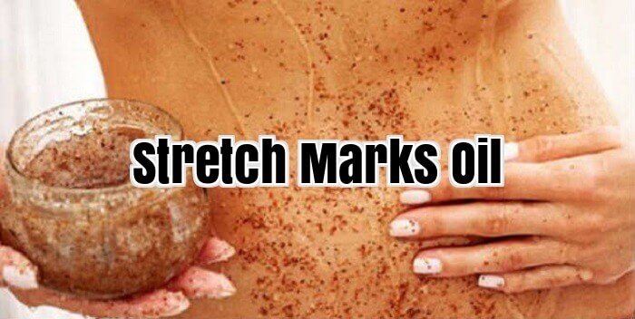 Stretch Marks Oil