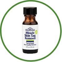 Miracle Skin Tag Remover Homeopathic Skin Tag Medicine
