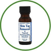Nature’s Vision Skin Tag Removal