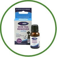 Provent Skin Tag Remover