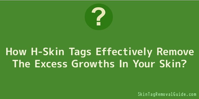 How H-Skin Tags Effectively Remove The Excess Growths In Your Skin