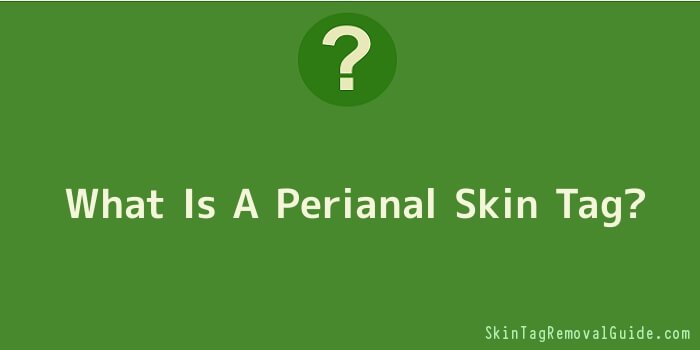 What Is A Perianal Skin Tag